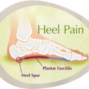 Heel Pain Ayurvedic Herbal Treatment